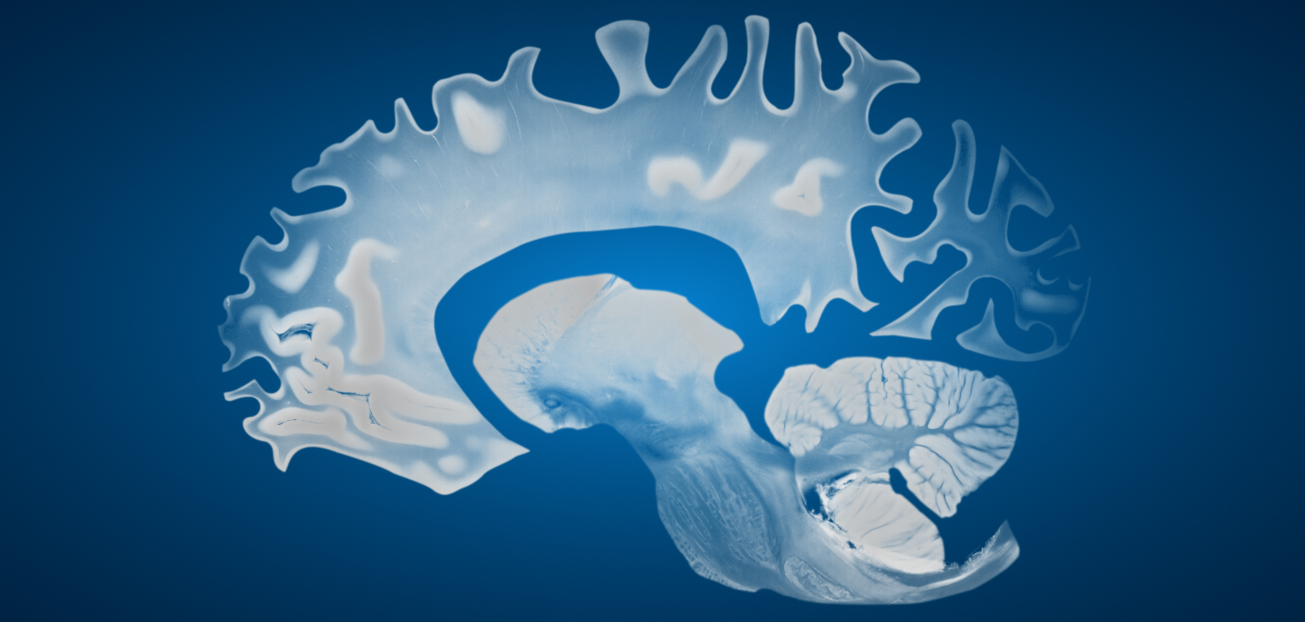 Cuidar amb dignitat: Alzheimer Catalunya Fundació i els reptes de la demència